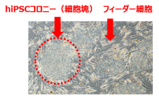 オンフィーダー培養したhiPSCの細胞形態