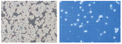 DEF-CS培養システムで培養したhiPSCの剥離剤処理後（左）と細胞数計測時の顕微鏡像（右）